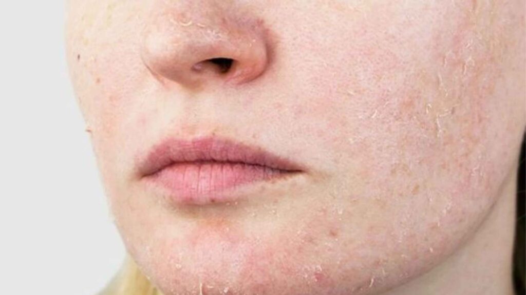 Salah Cuci Muka Bisa Bikin Kusam! Ini 5 Kesalahan yang Mungkin Kamu Lakukan