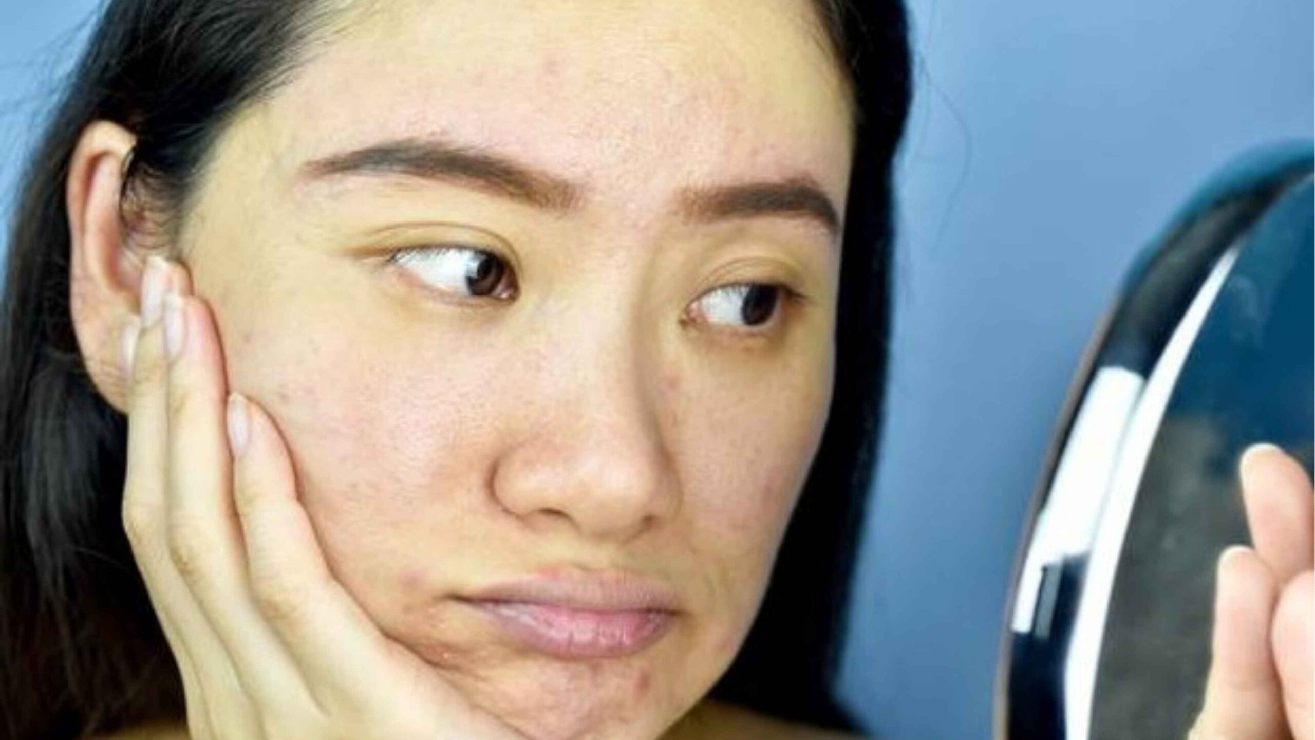 Salah Cuci Muka Bisa Bikin Kusam! Ini 5 Kesalahan yang Mungkin Kamu Lakukan