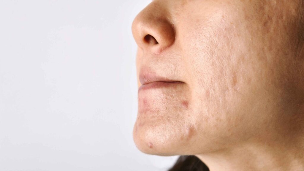 Stop Salah Kombinasi Skincare