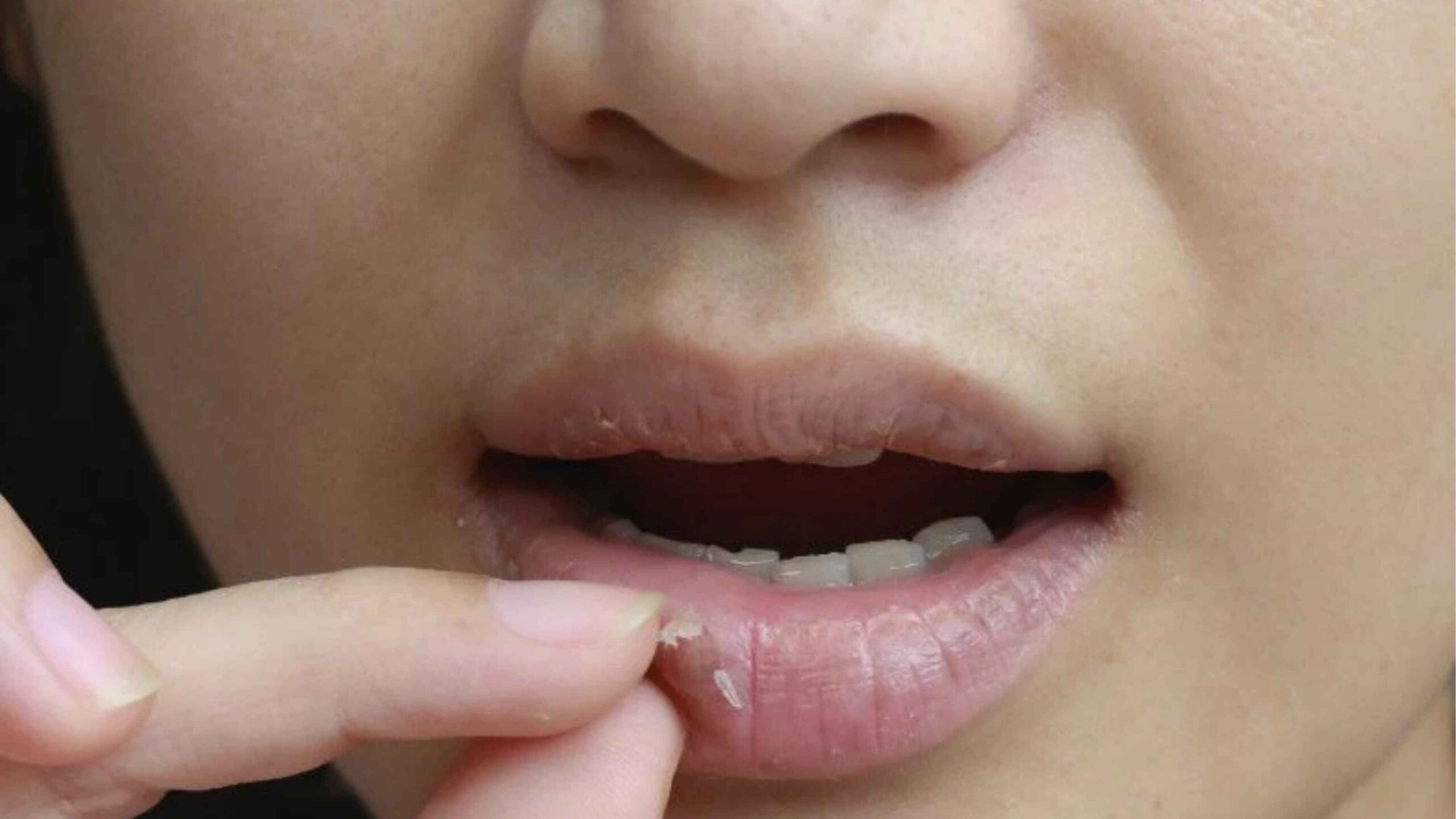 Cara Merawat Bibir Kering