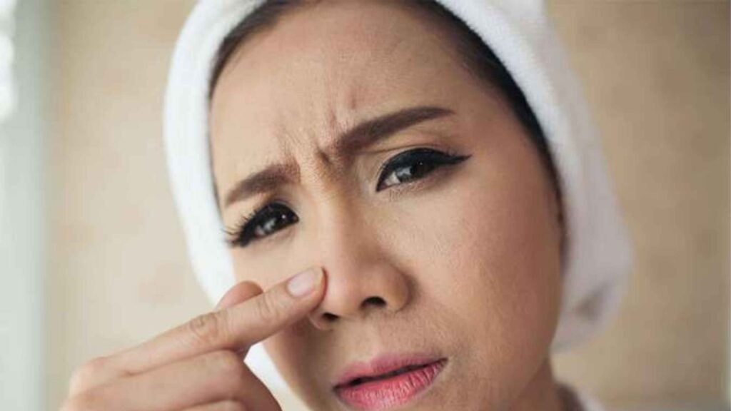 Lipatan Hidung Sering Kering