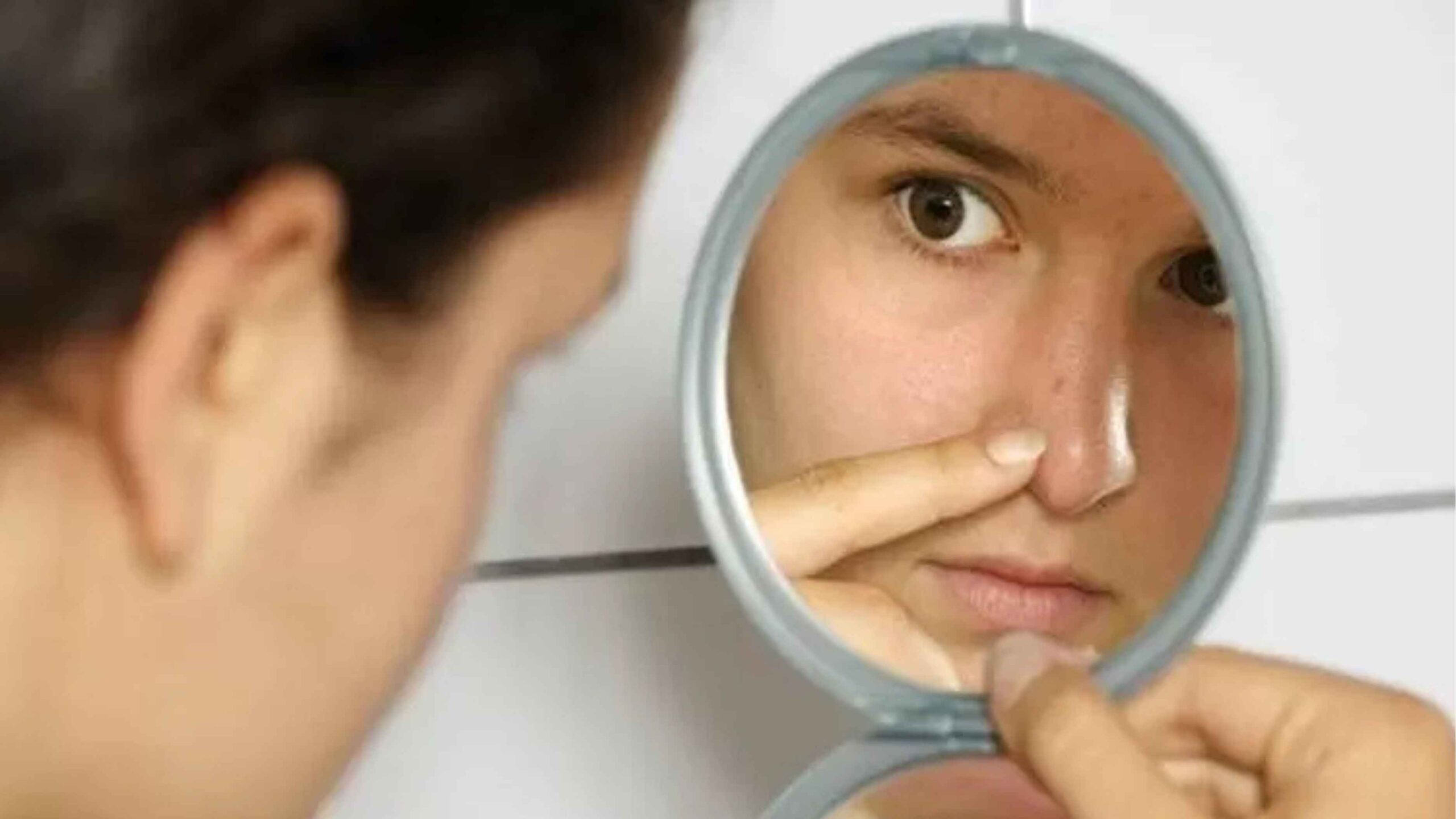 Lipatan Hidung Sering Kering